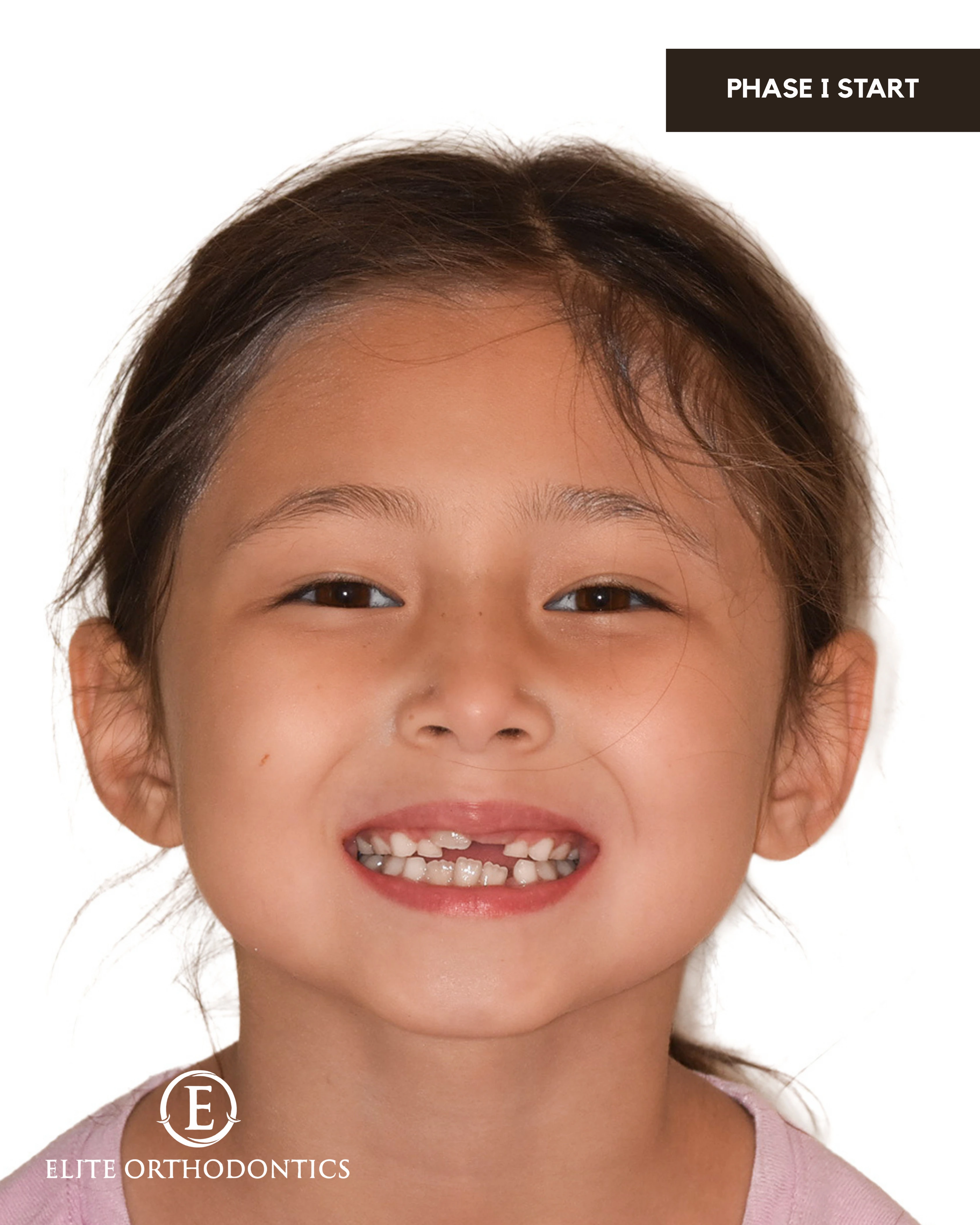 Phase I clinical progression image 2