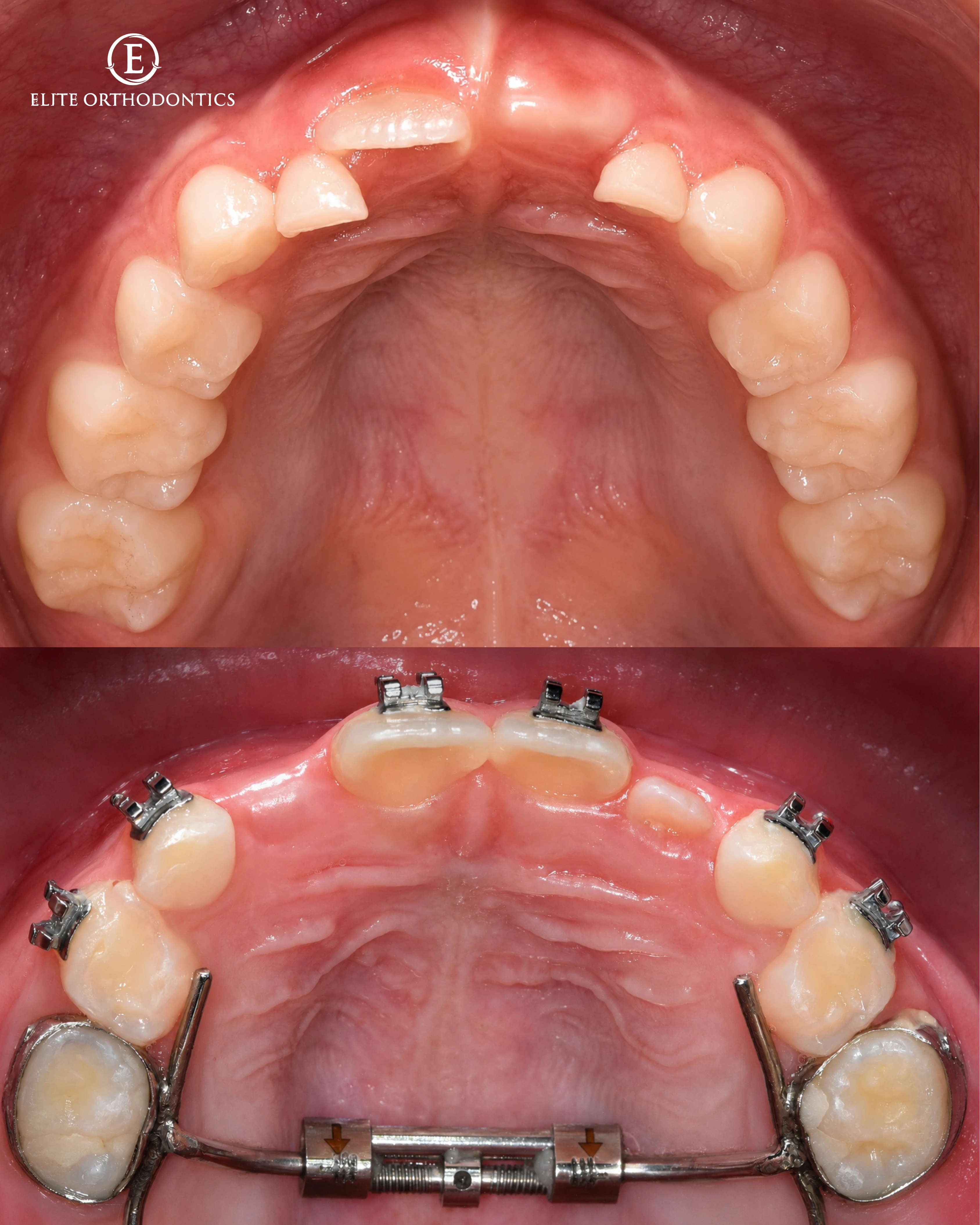 Phase I clinical progression image 3