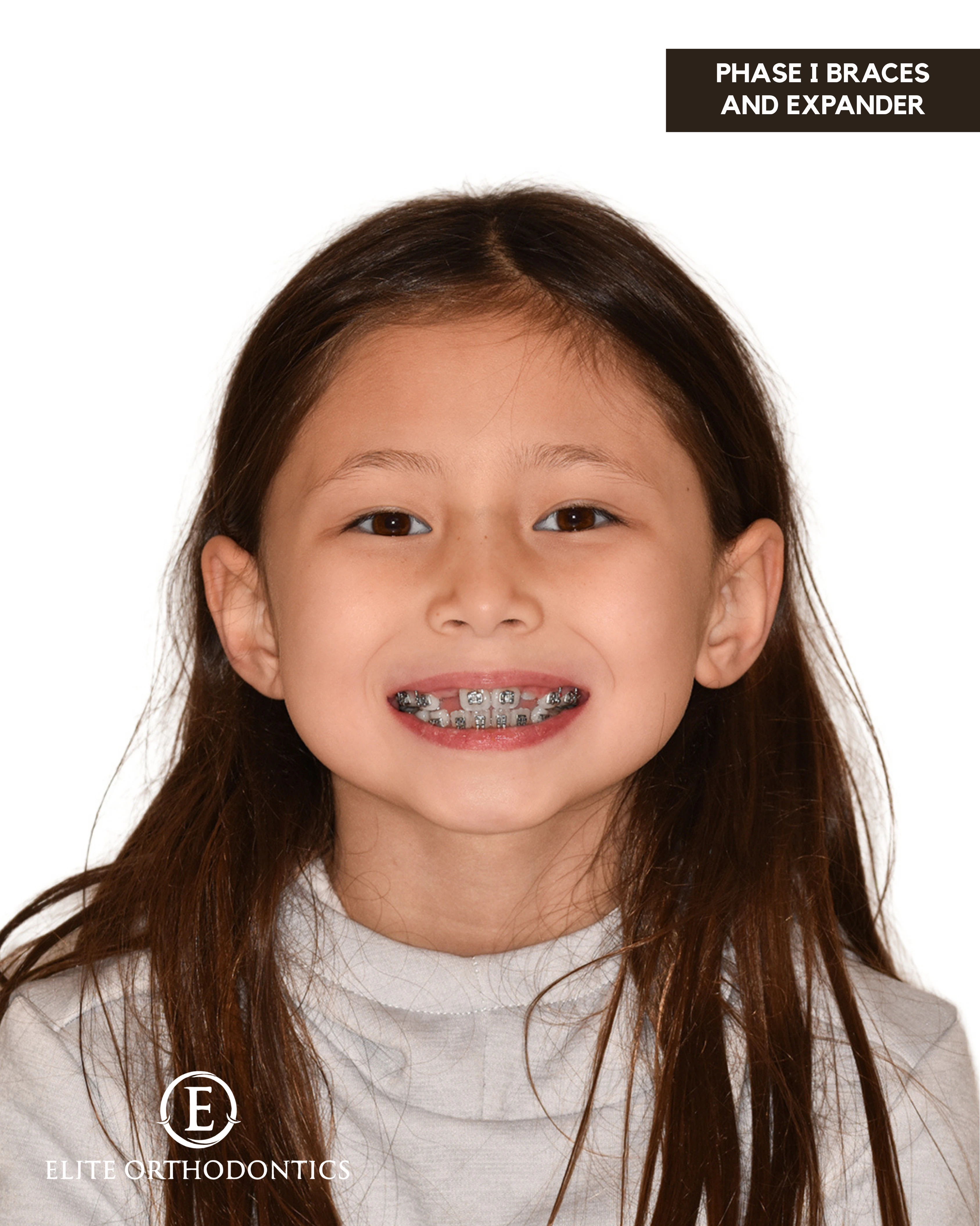 Phase I clinical progression image 4