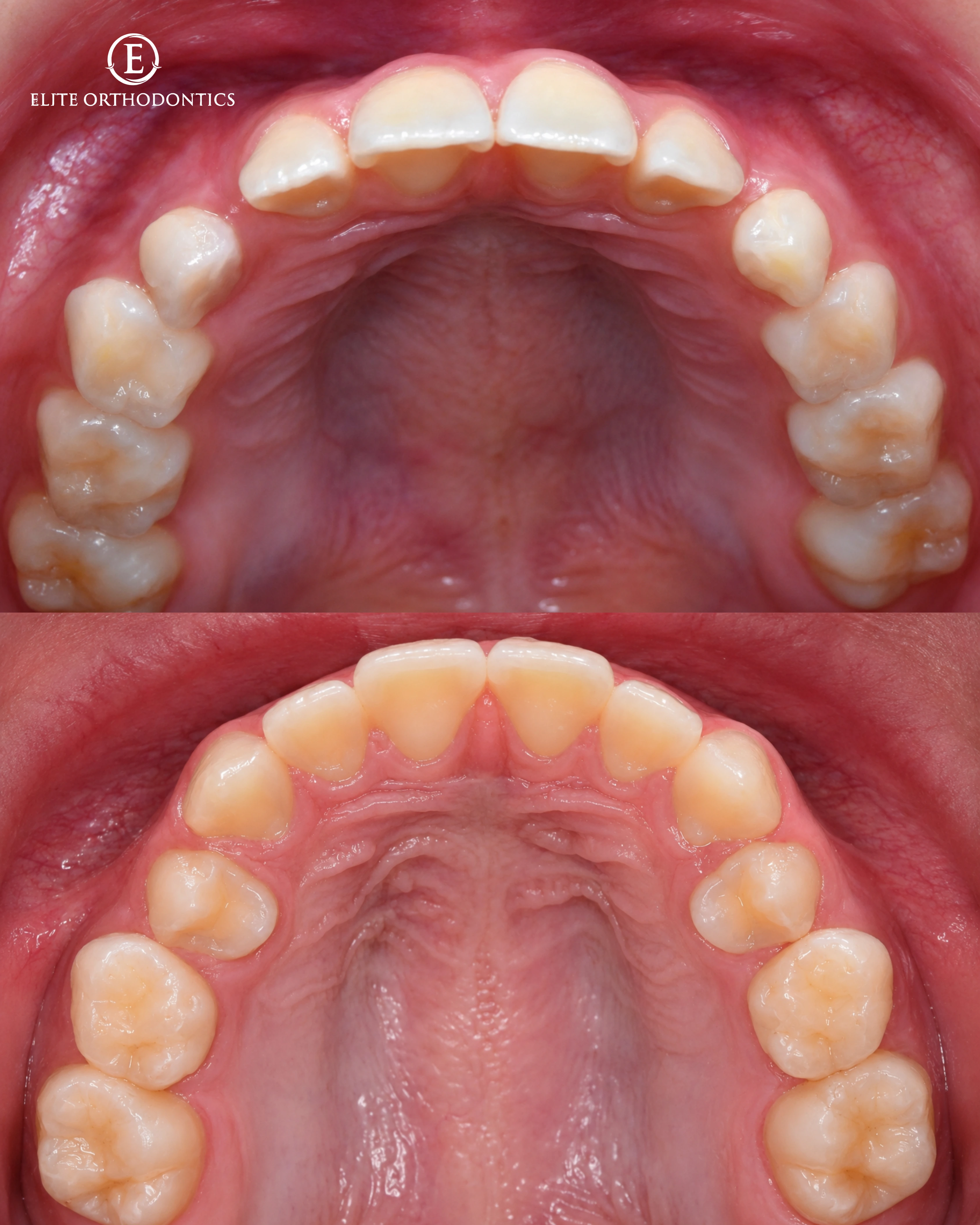 Phase I clinical progression image 6
