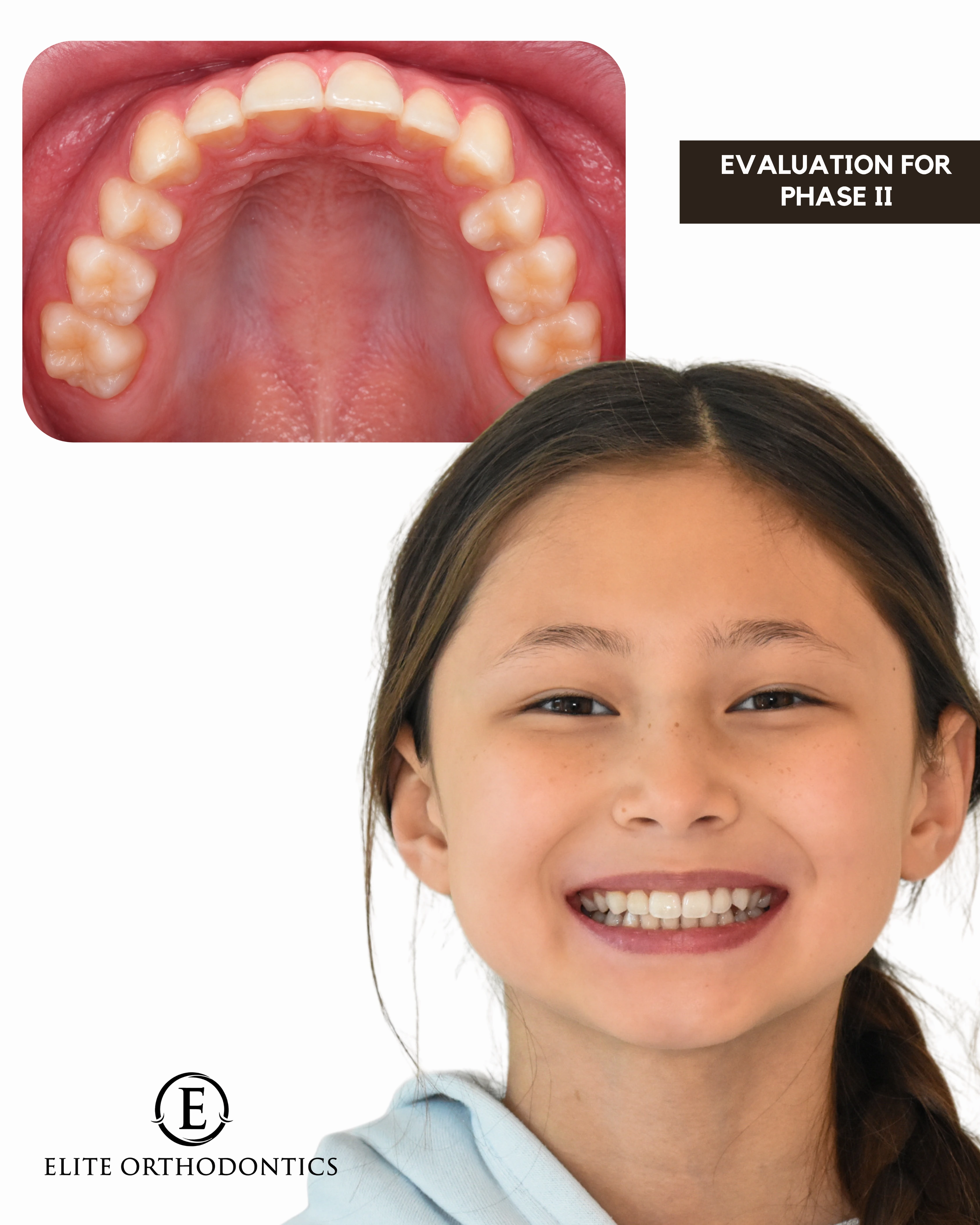 Phase I clinical progression image 8